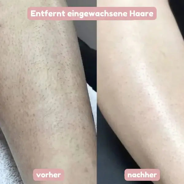 BloomShave™ - 2-in-1 Damen Körperrasierer