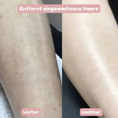 BloomShave™ - 2-in-1 Damen Körperrasierer