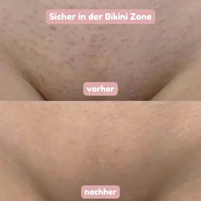 BloomShave™ - 2-in-1 Damen Körperrasierer